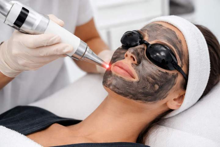 Soin du visage au laser carbone Gatineau
