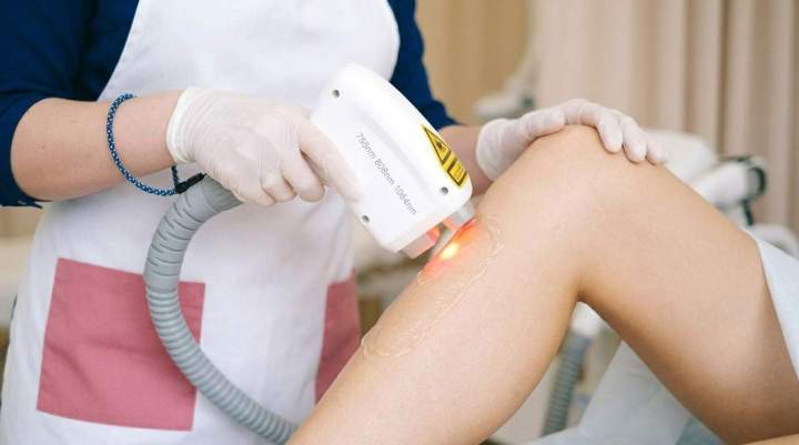 Épilation jambe au laser diode Gatineau