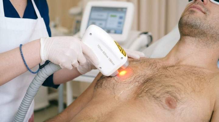 Épilation au laser diode Gatineau