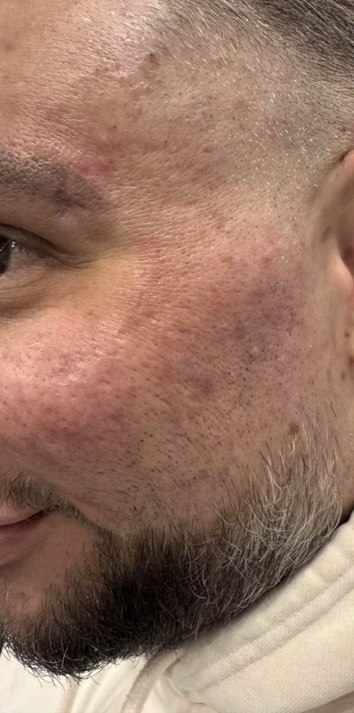 Avant Hollywood peel Homme