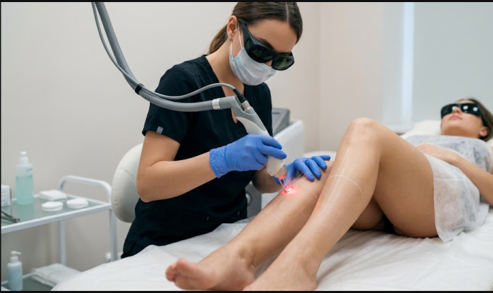 Epilation permanente au laser Gatineau