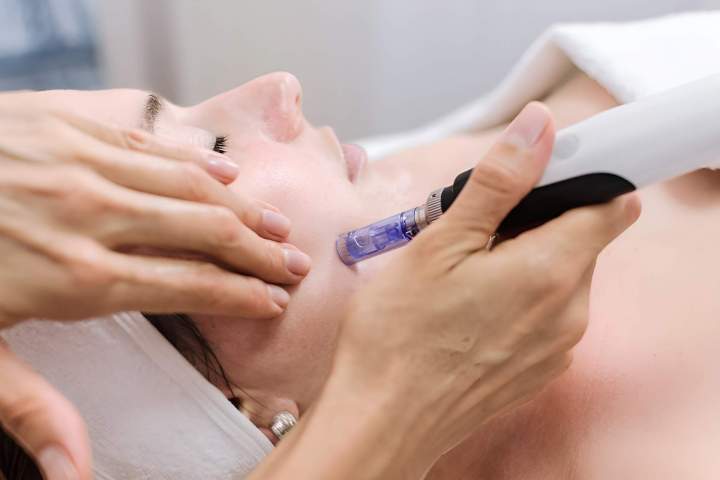 Soin microneedling Gatineau