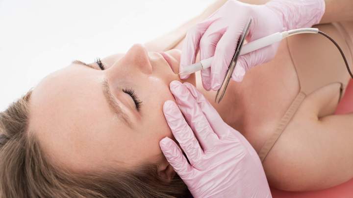 Laser facial hair removal Gatineau