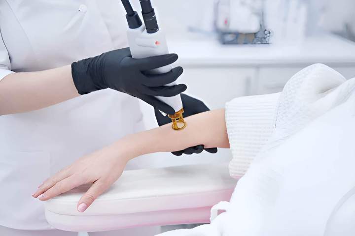 Service d’épilation définitive au laser Alexandrite Outaouais