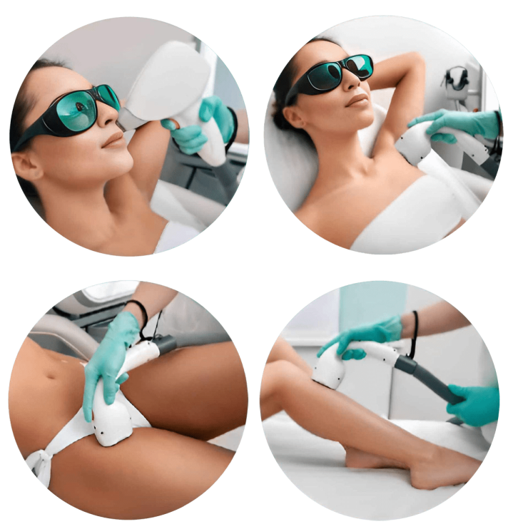 Permanent laser hair removal Outaouais