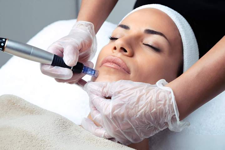 Hair removal session Gatineau